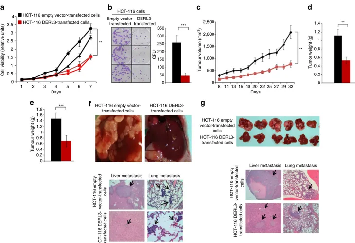 Figure 2 | Restoration of DERL3 expression has tumour suppressor-like properties in vitro and in vivo