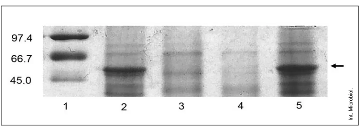 Fig. 1. Outer membrane protein profiles. Black arrows indicate the position of OprD. Lane 1: SDS-PAGE standards, (Low Range, Bio-RAD, USA); lane 2: strain PA110514; lane 3: strain PA116136; lane 4: strain PA138635 (imipenem-resistant control); lane 5: stra