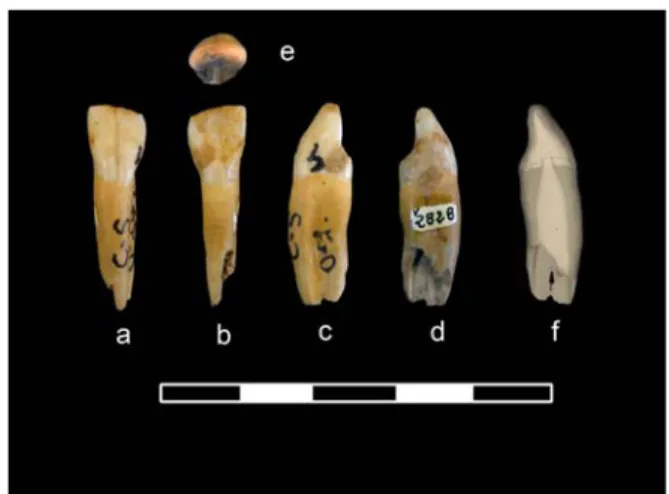 Figure  1.  Incisor  from  the  “La  Cova  del  Gegant”  in  buccal  (a),  lingual  (b),  distal  (c),  mesial  (d),  and  occlusal  (e)  views  as  well  as  a  virtual  reconstruction  (f)  in  distal  view  to  observe  the  shape of the pulp cavity