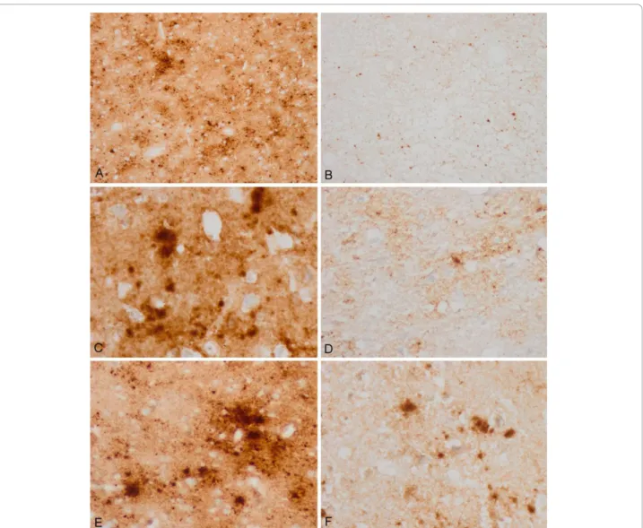 Figure 2 3F4 immunohistochemistry without and with proteinase K pre-treatment in the same regions of consecutive serial sections