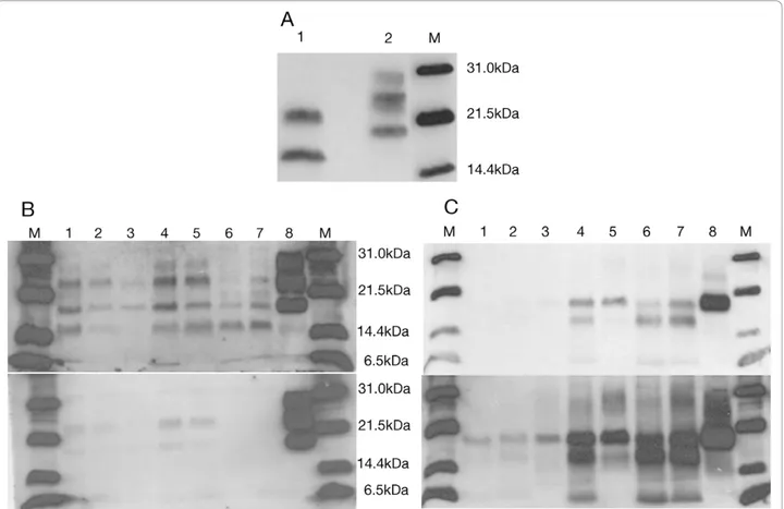 Figure 5 Immunoblot images under modified methodology. A. Immunoblot with TeSeE® Western kit of patient occipital cortex (1) and sCJD VV2 control (2) incubated with Mab Sha31