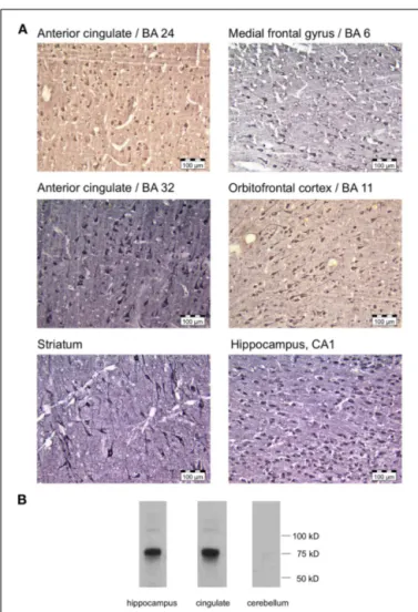 FIGURE 4 | Expression of AKAP5 in the human medial frontal cortex. (A) Top, middle row: strong AKAP5 immunoreactivity was observed in pyramidal cells and a subset of interneurons in the medial anterior cingulate (BA 24, 32) and in the medial PFC/supplement