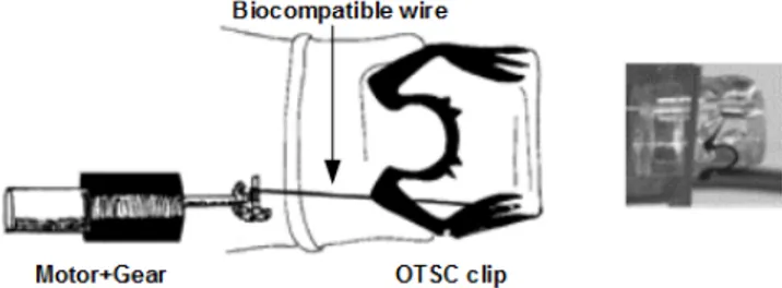Fig. 3. Schema and detail of the release mechanism. The BLDC motor pulls a wire attached to the OTSC clip.
