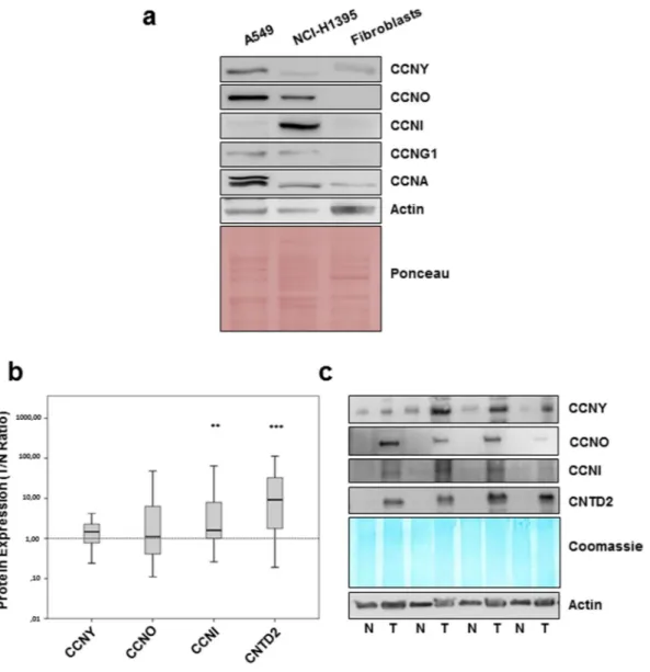 Figure 1.  CNTD2 and CCNI are overexpressed in human lung cancer tissues. The expression of orphan cyclins 