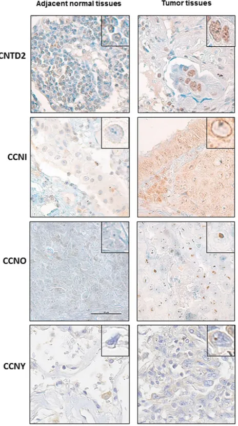 Figure 2.  Cellular location of overexpressed orphan cyclins in human lung tissues. Representative images of 