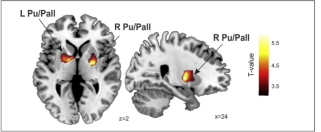 Fig. 4 e Fluency correlated with gray matter volume. Correlations were rendered onto sagittal and coronal views with MNI coordinates at the bottom right of each slice
