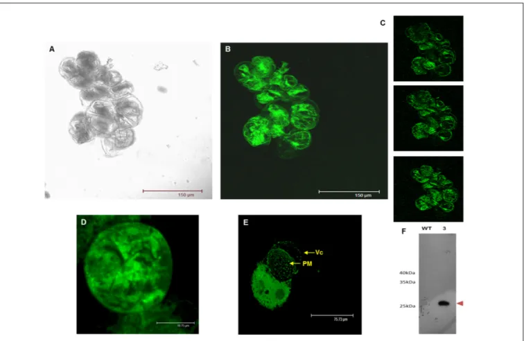 FIGURE 7 | Transient expression of GSTU-2 fused with GFP distributed by grapevine cells and protoplasts 3 days after infection in A