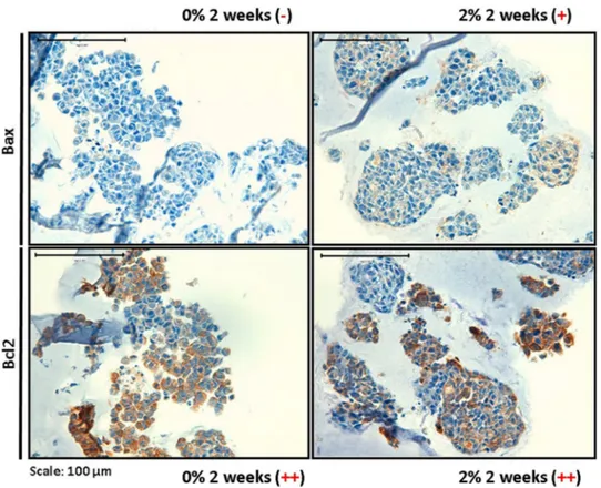 Figure 5.  Study of apoptosis and antiapoptosis. Immunohistochemistry images (40×) of Bax and Bcl2 markers