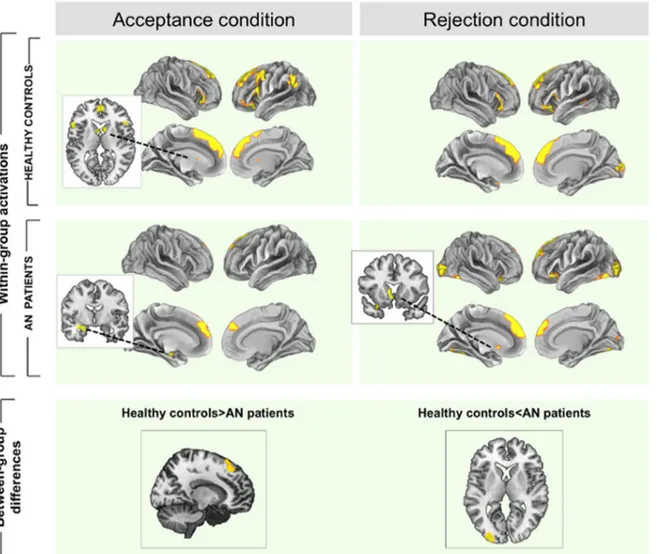 Fig 2. Within and between-group brain activations during acceptance and rejection feedback