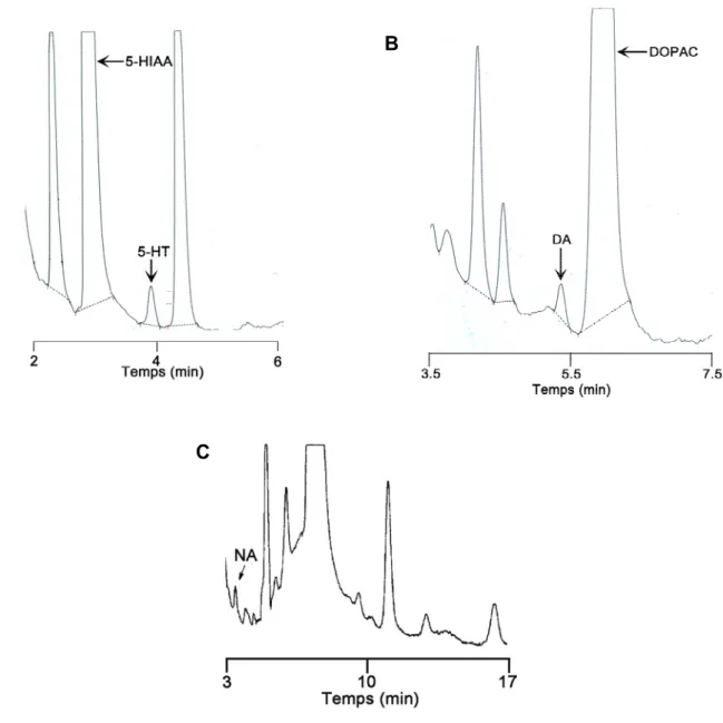 Figura 13. Cromatogrames d’ una mostra de dialitzat a l’ EPFm de rata mostrant la 
