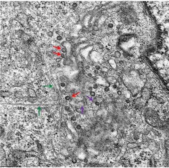 Fig. 3 The pharmacological blockade of the myosin II motor activity by blebblistatin in NRK cells produces an accumulation of peri-Golgi vesicles close to swollen cisternae