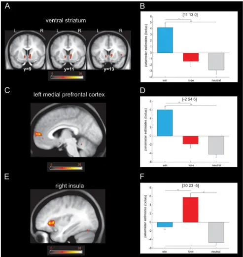 Figure 6. Brain responses to the outcome. A, Activation in the ventral striatum revealed by a one-way ANOVA with valence as factor ( p ⬍ 0.001 uncorrected; p ⬍ 0.05 SVC)