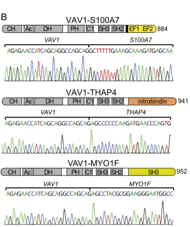 Fig. 1. VAV1 fusion genes in PTCL. (A) Schematic representation of the domain structure of the VAV1 protein