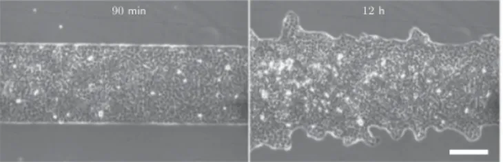 FIG. 1. Fingering in epithelial spreading. Scale bar, 200 μm. Adapted from [6] with permission from Pascal Silberzan.