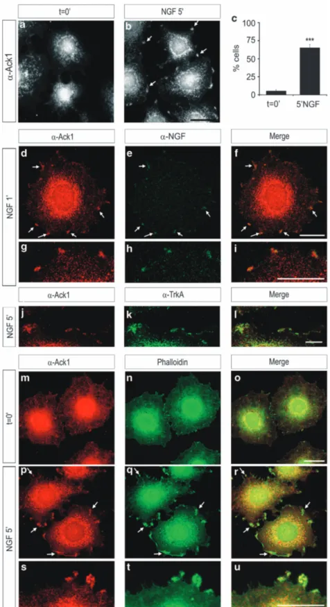 Figure 3 Neurotrophin treatment causes a re-organization of Ack1 in PC12 cells. Immunostaining analyses of PC12 cells showing the distribution of Ack1 in untreated cells (a) and after NGF treatments (b)