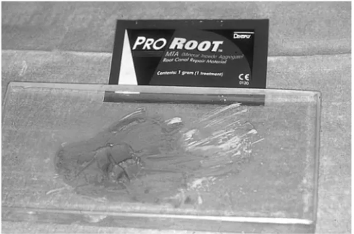 Figura 1. Fotografía de ProRoot-MTA en su presentación comercial. Figura 2. Mezcla de ProRoot-MTA en loseta a punto de utilizarse