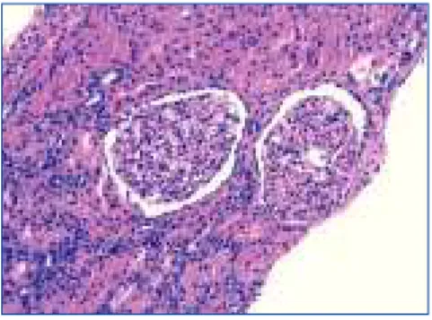 Figure 2.  Renal biopsy.