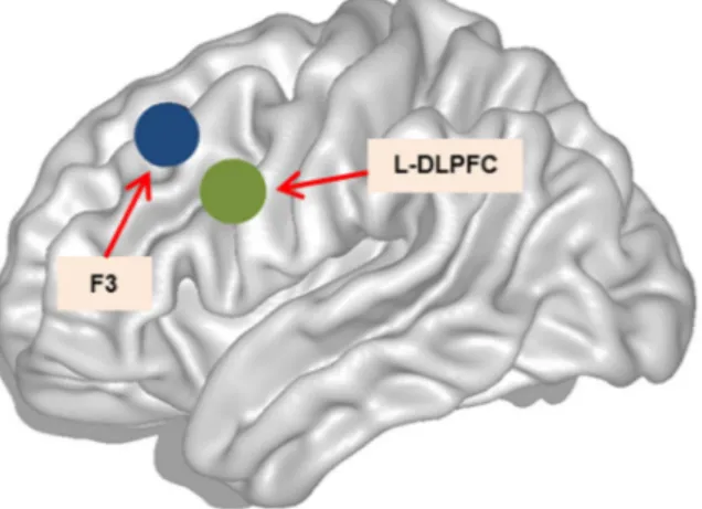 Figure 5.  TMS at the L-DLPFC. Left hemisphere sagittal view. Green circle represents the stimulation point  for the L-DLPFC, within MNI space coordinates (x, y, z) of −42, 10, 30
