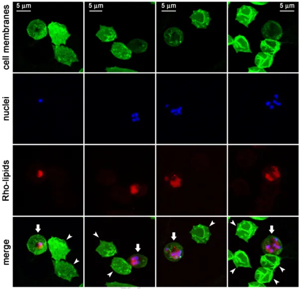 Figure 2. Fluorescence confocal microscopy analysis of the fate of Rho-labeled lipids incorporated in the formulation of pRBC-targeted immunoliposomes added to living P