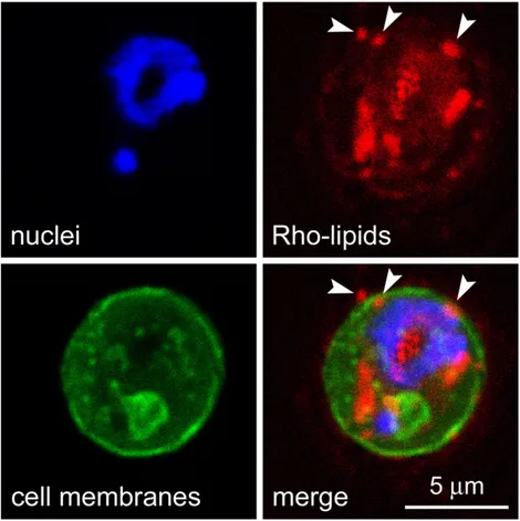 Figure 3. Fluorescence confocal microscopy analysis of a pRBC showing the subcellular distribution of Rho-labeled lipids incorporated in the formulation of pRBC-targeted immunoliposomes added to living P