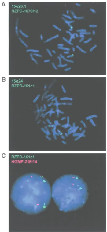 Figure 4 Localization of LCR15–1, LCR15–2, and LCR15–3 on 15q by FISH analysis. Probes used were RZPD-1070i12 (15q26.1) (A) and RZPD-161c1 (15q24) (B)