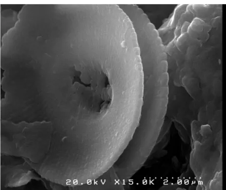 Figure 1: SEM micrograph of a calcareous nannoplankton (coccolithophore) in marine Miocene 