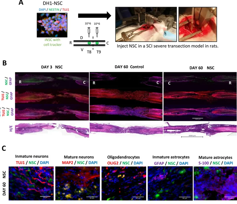 Figure 11. Clinical grade human iPSCs derived NSC engraft and migrate to the lesion site in a  Spinal Cord Injury (SCI) rat model