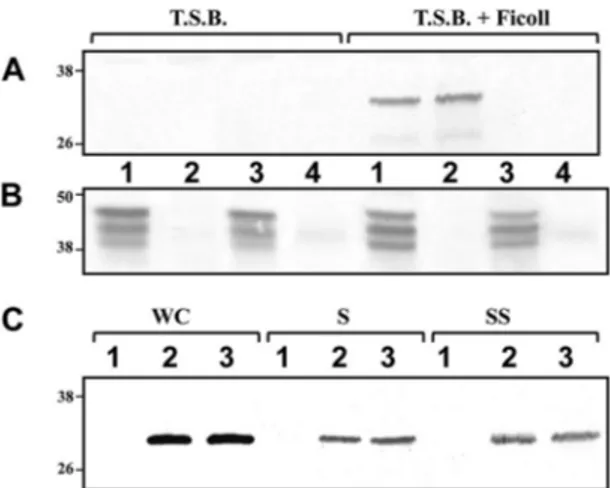FIG 2 (A) Western blot analysis with anti-lateral flagellin (1:1,000) polyclonal