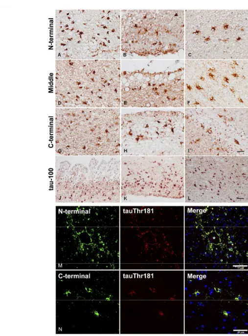 Figure 1: A-L: single immunohistochemistry with anti-tau antibodies directed to N-terminal, middle, and C- C-terminal regions of tau