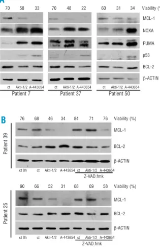 Figure 5.  Apoptosis profile induced by Akti-1/2 and A-443654. ( A ) Apoptosis-related protein expression profile induced by Akti-1/2 and A-443654