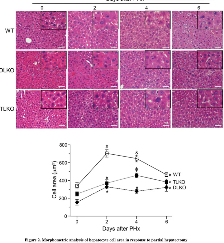 Figure 2. Morphometric analysis of hepatocyte cell area in response to partial hepatectomy Representative H&amp;E-stained sections of livers isolated from WT, DLKO and TLKO mice  before (T=0) and after PH (2, 4 and 6 days)