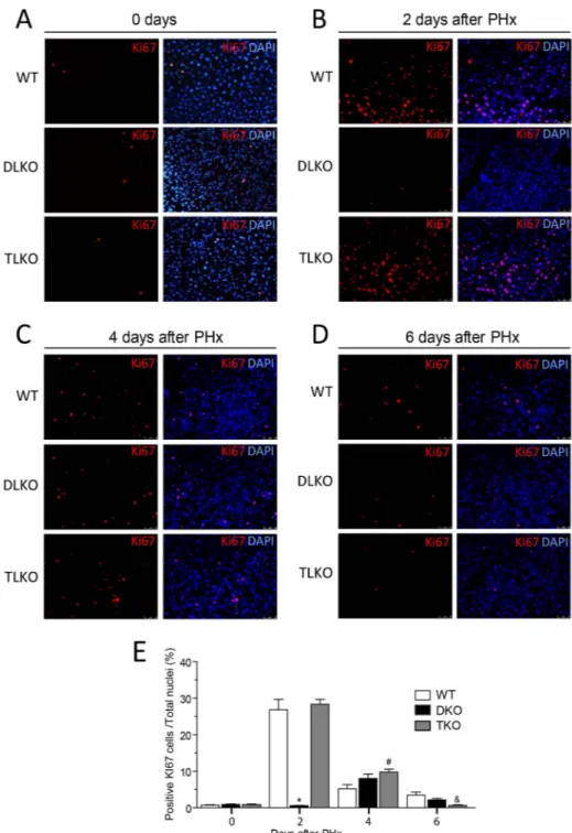 Figure 4. Genetic ablation of FoxO1 restored cell proliferation in Akt-deficient regenerative  livers