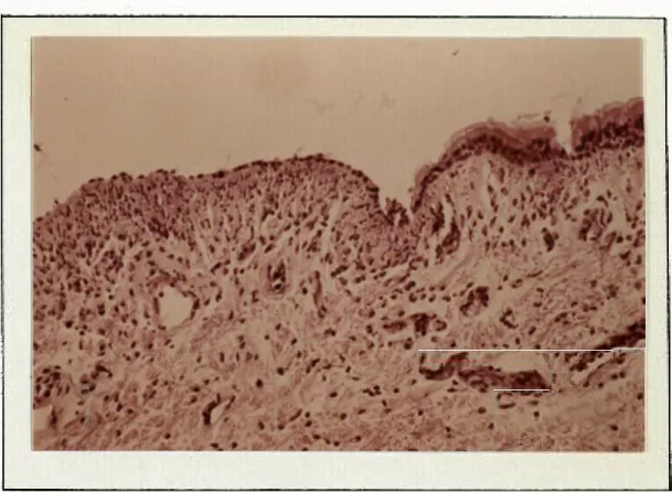 Fig. 32 Manguito tipo A - 48  h . ( X 40  ) . 