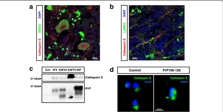 Fig. 7 Neuronal Cathepsin S in sCJD. Immunohistochemical staining of FC sCJD cases double-immunostained with Cathepsin S (red) and (a) SIM32 (green) or LAMP2 (b)