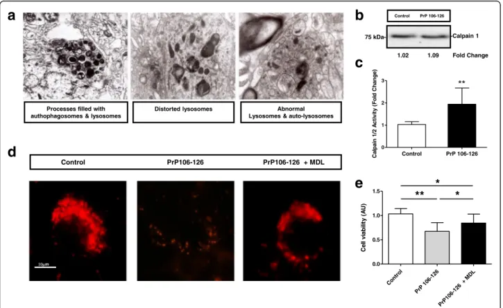 Fig. 4 Abnormal lysosomes in sCJD are dependent on Calpain over activation. a TEM images indicating the presence of processes with autophagosomes and lysosomes, distorted and abnormal lysosomes and auto-lysosomes in neurons of the frontal cortex of sCJD ca