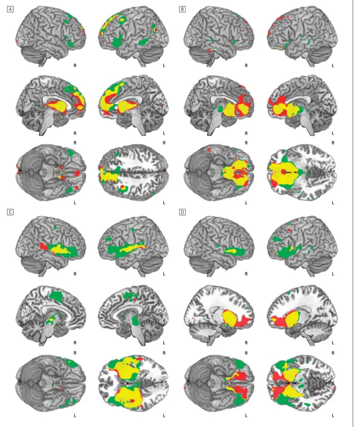 Figure 2. Significant within-group (main effect) corticostriatal functional connectivity maps of the dorsal caudate (A), ventral caudate/nucleus accumbens (B), dorsal putamen (C), and ventral putamen (D) seeds