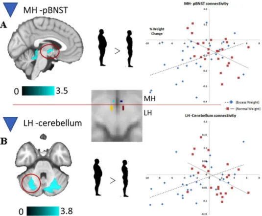 Figure 2.  Brain regions displaying a significant between-group interaction in the relationship between MH 