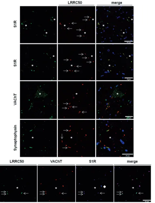 FIGURE 3. Double-labeling (upper panel) and triple-labeling (lower panel) immunofluorescence and confocal microscopy to LRRC50 and sigma 1 receptor (S1R), vesicular acetylcholine transporter (VAChT) or synaptophysin (SYN) in normal motor neurons of the hum