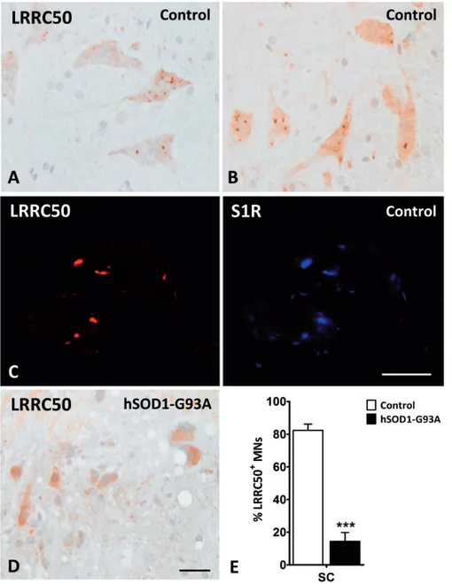 FIGURE 4. LRRC50-immunoreactive boutons in motor neurons of the spinal cord in mice. (A, B) LRRC-50 immunoreactivity is found in cytoplasmic structures in control mice