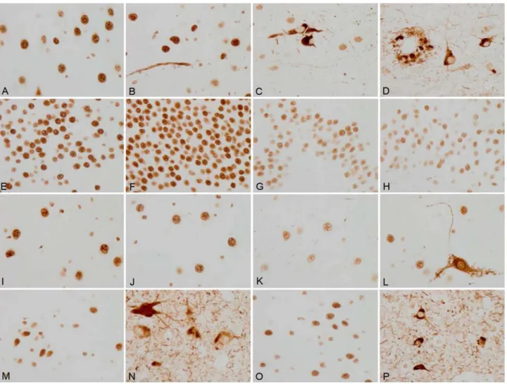 Figure 4. Tau-100 immunohistochemistry. A–D. CA1 region of the hippocampus; E–H. dentate gyrus; I–L