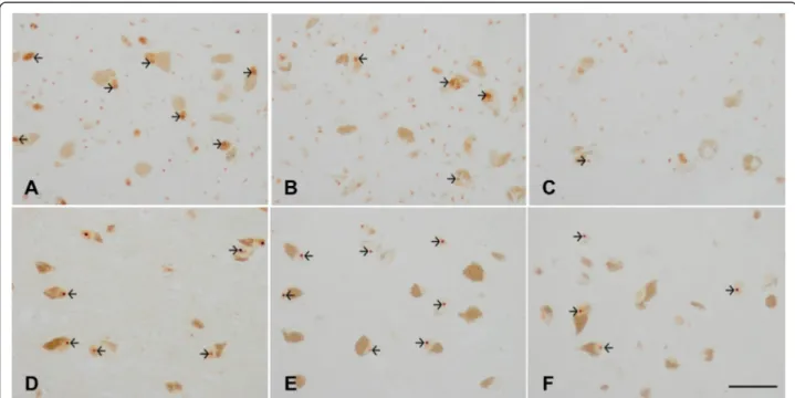 Fig. 7 a-c: Nucleophosmin (NPM1) immunohistochemistry in the substantia nigra pars compacta in PD at stages 1 –2 (a), 3–4 (b), and 5–6 (c) showing NPM1 immunoreactivity in the nucleoli (arrows)