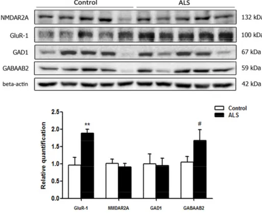 Figure 6.  Gel electrophoresis and western blotting to glutamate receptor ionotropic, NMDA 2A (NMDAR2A), α‐ amino‐3‐hydroxy‐5‐methyl‐4‐isoxazolepropionic  acid  receptor  1  (GluR‐1),  glutamate  decarboxylase  1  (GAD1) and  gamma‐aminobutyric  acid  rece