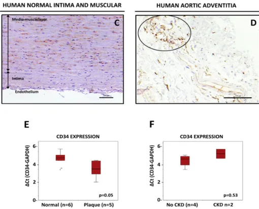 Figure 2. Detection of CD34-positive cells in human aortic tissue. Whole human arteries were isolated,  sliced, prepared for IHQ analysis and stained for CD34 as described in Material and Methods
