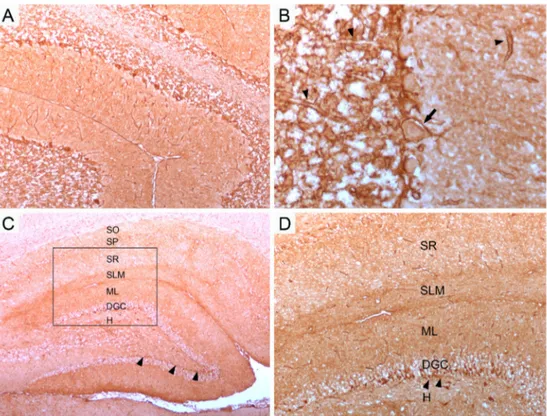 Figure 1.  Staining pattern of a patients´ serum with NMO-IgG/AQP4-antibodies in rat brain