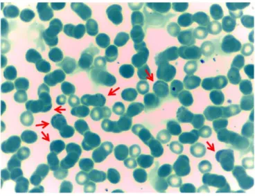 Figure  1.  Giemsa-stained  red  blood  cells.  Arrows  mark  red  blood  cells  with  internal  bodies,  which  leads  to  misidentification