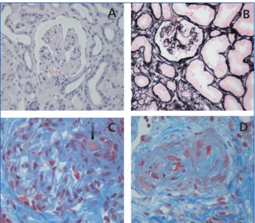 Figure 1.  Renal histopathological lesions from haemolytic