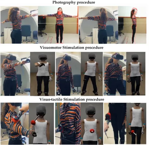 Figure 2. Visuomotor and visuo-tactile stimulations conducted in the pre-assessment and post- post-assessment sessions and in each treatment session