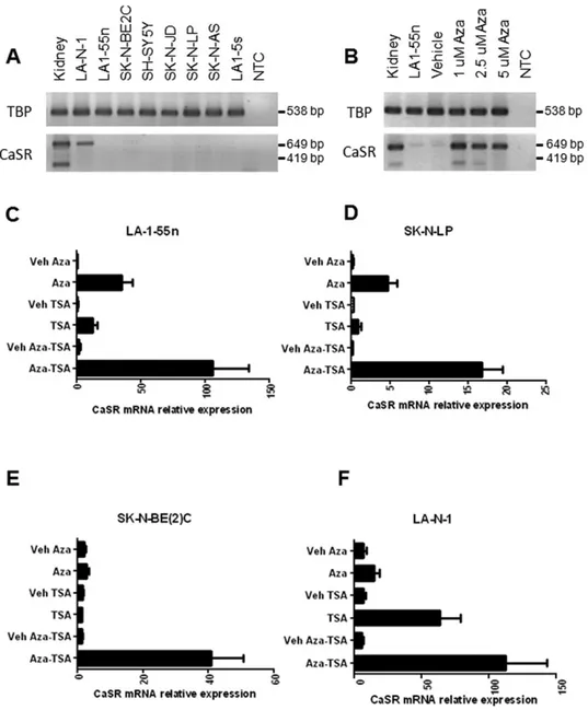 Fig. 1.  Upregulation of the CaSR gene in neuroblastoma cell lines exposed to epigenetic modifiers