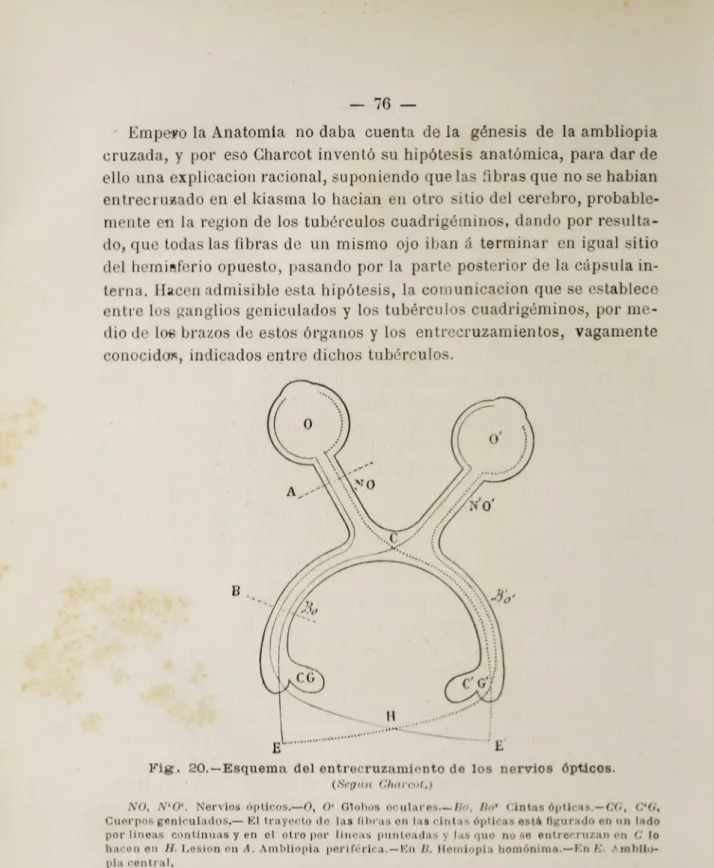 Fig . 20.—Esquema del entrecruzamiento de los nervios ópticos.
