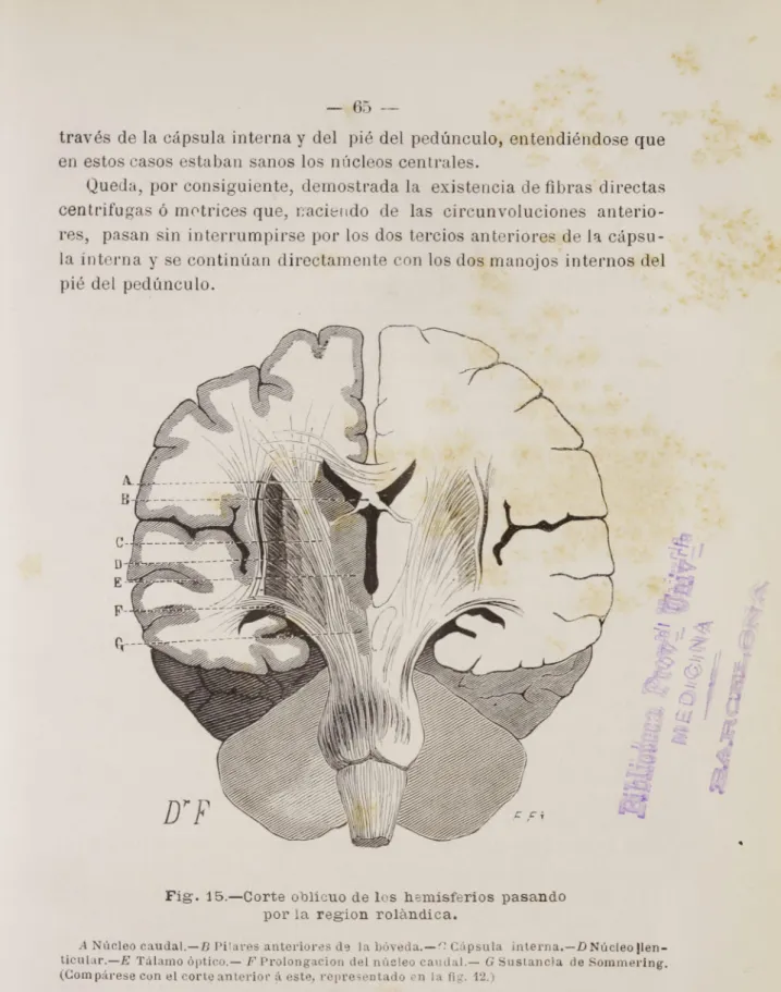 Fig. 15.—Corte oblicuo de los hemisferios pasando por la region rorandica.